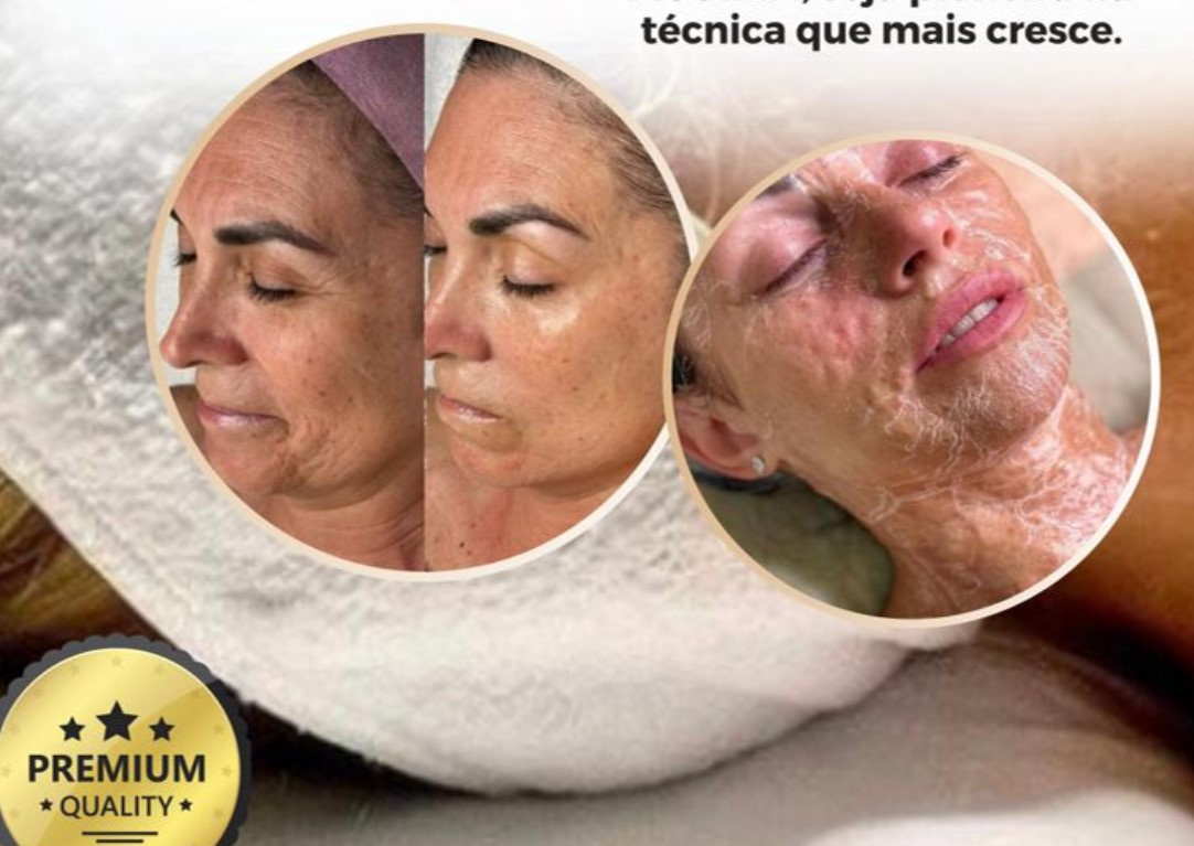 👉 Curso Enzima Botox Pavanelo Certificado com Reconhecimento Mundial Curso.blog.br